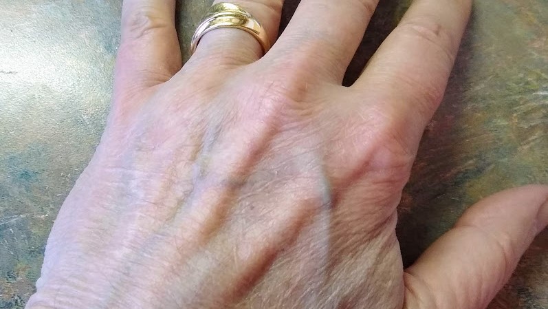 Bill Tammeus' left hand