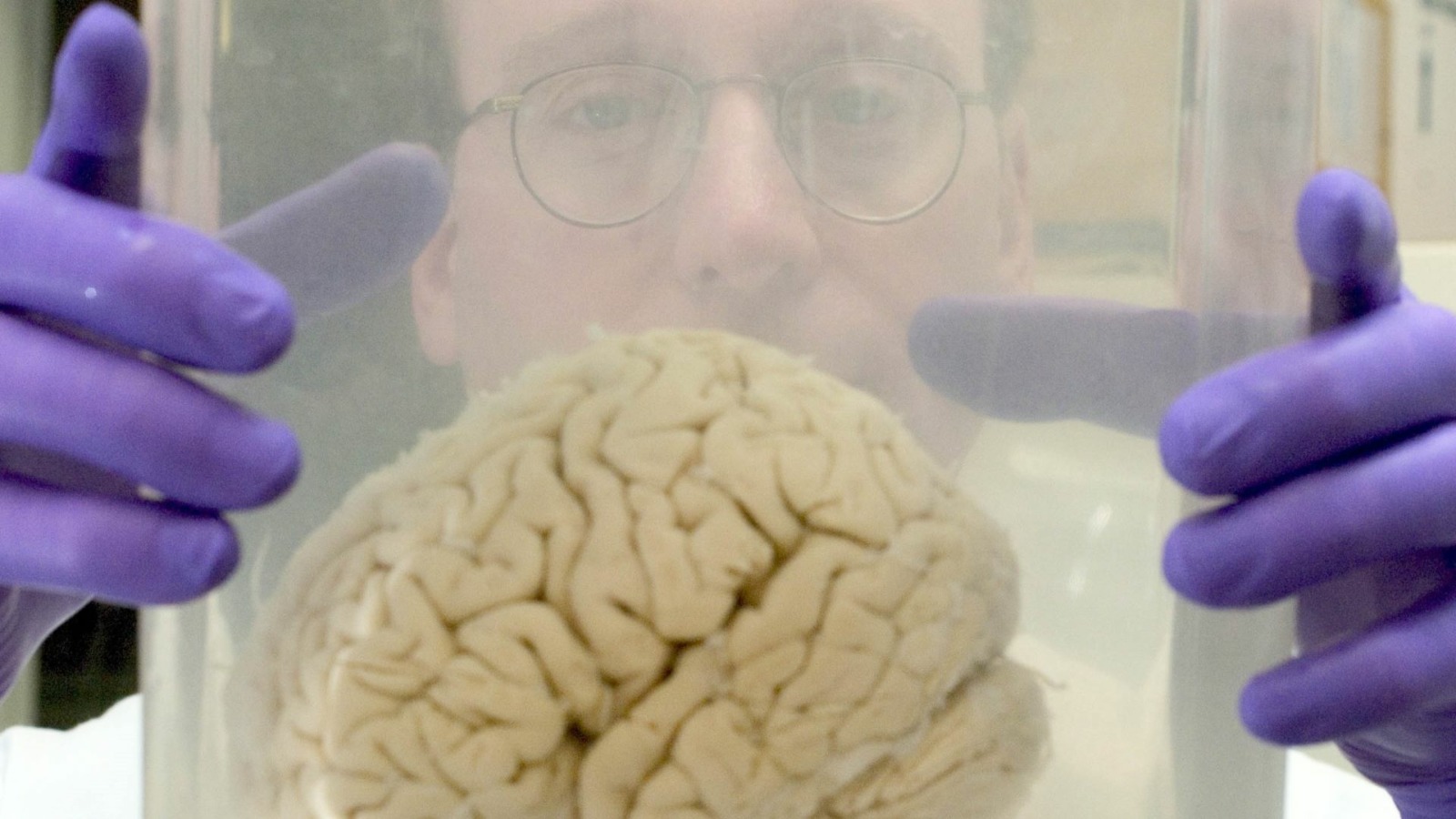 A man holds a brain used for research.