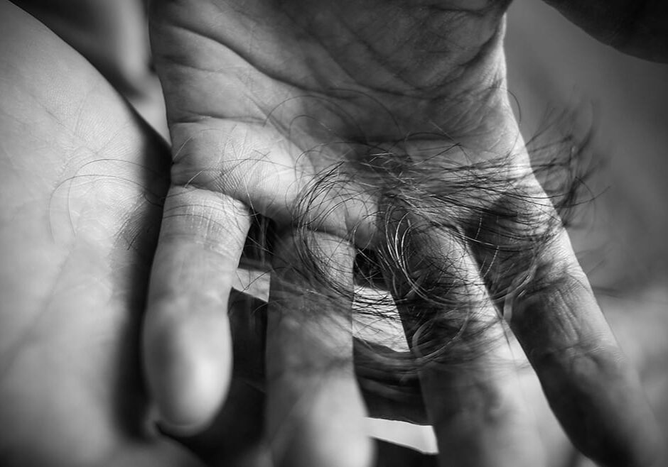Krista Graham's hand filled with hair after she ran her fingers through just to see how much would come out. (Photo by Angie Jennings)