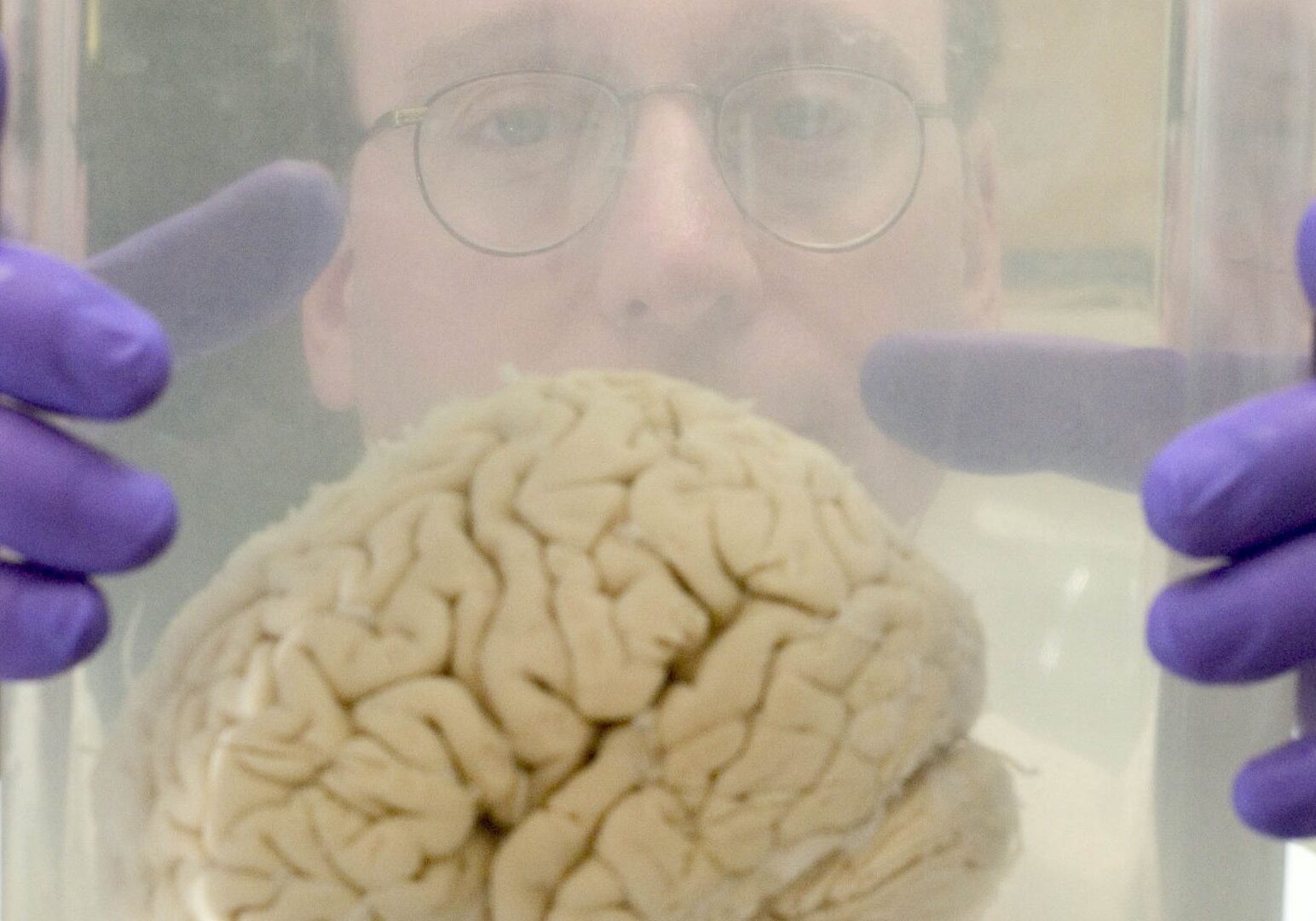 A man holds a brain used for research.