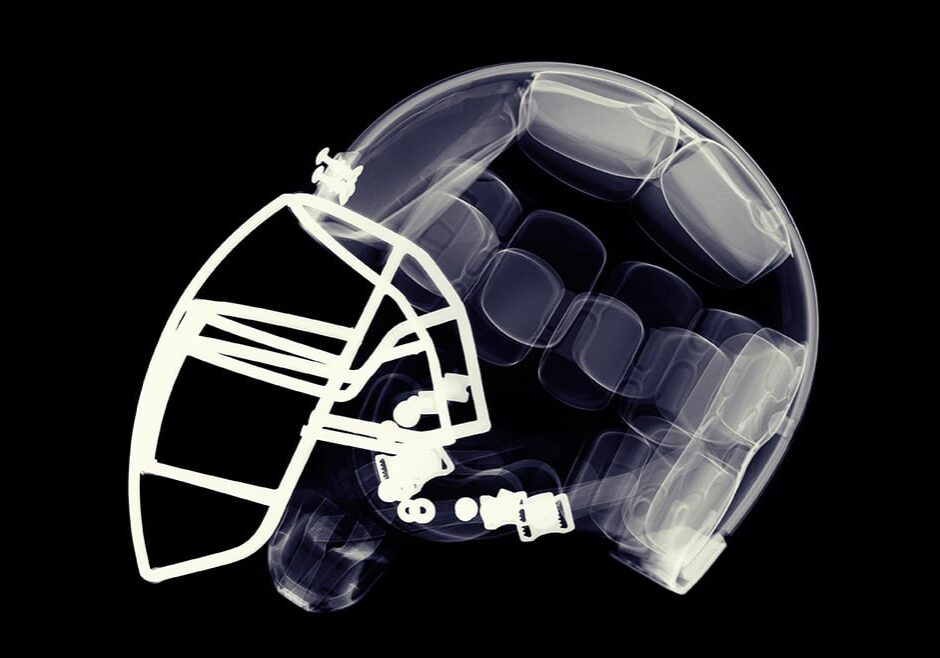 X-ray image of football helmet.
