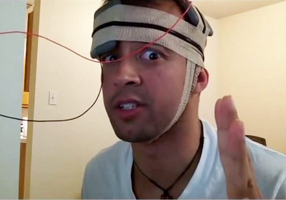 A man with electrodes on his brain